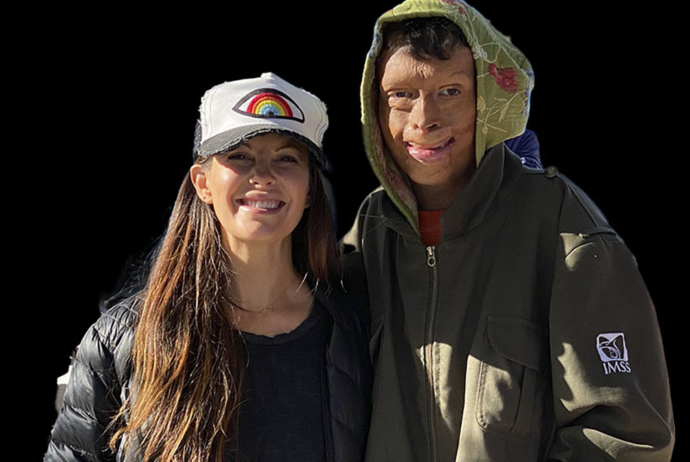 Marybeth with Arturo, burn victm.